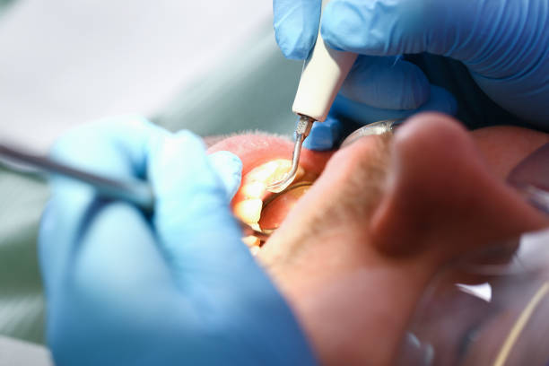 Best Emergency Cosmetic Dentistry in Dexter, MI