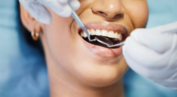 Best Emergency Dental Extractions in Dexter, MI
