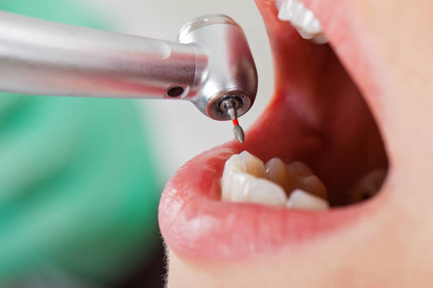 Best Weekend Emergency Dentist in Dexter, MI